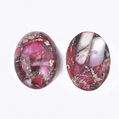 Synthetic Gold Line Regalite/Imperial Jasper/Sea Sediment Jasper Cabochons G-S329-079E-1