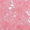 Glass Seed Beads X1-SEED-H002-E-A1409-3